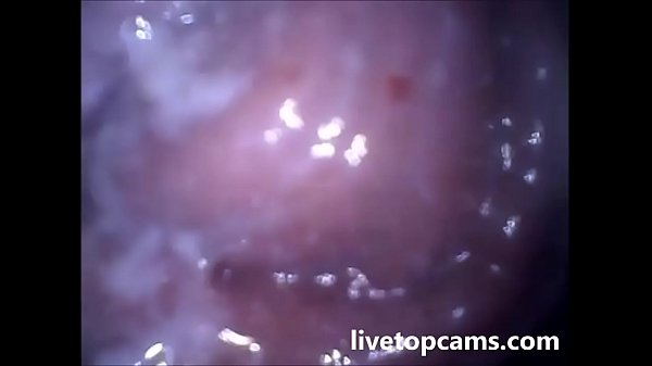 Microscopic photo inside the vagina